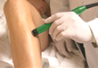 La informaci�n de la depilaci�n del l�ser aqu�